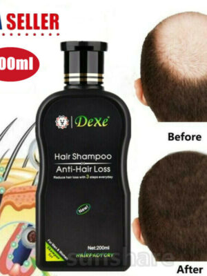 200ml Dexe Original Anti Hair Loss Shampoo Natural Herbal Hair Growth Treatment